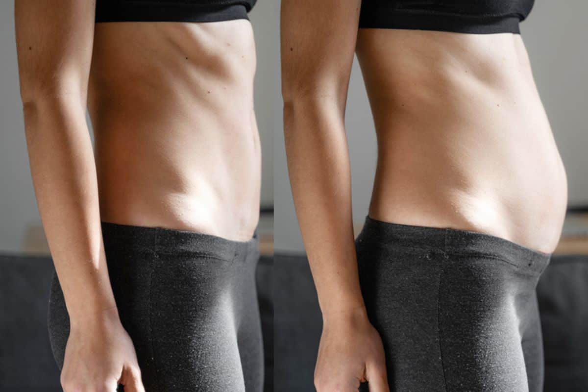 How long does diastasis recti take to improve Christchurch?