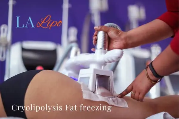 women getting fat freezing Christchurch
