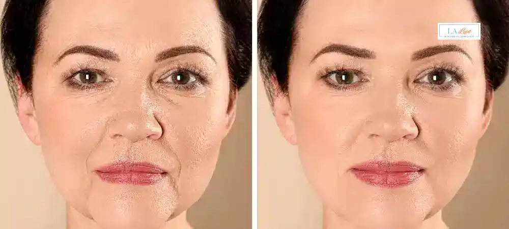 Why Aren’t My Skincare Products Making My Sagging Skin Look Firmer Christchurch?